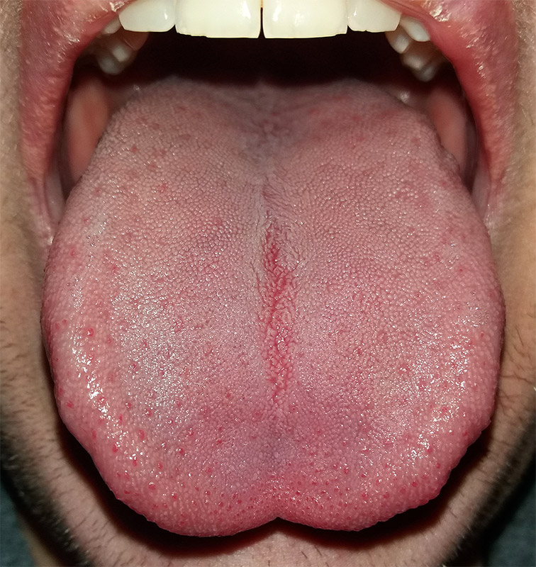 The Tongue